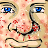 Acne Be Gone // Game